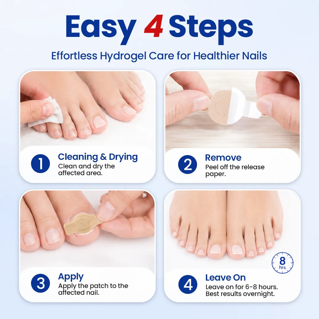 ROSOPLTMFungal Nail Repair Patches