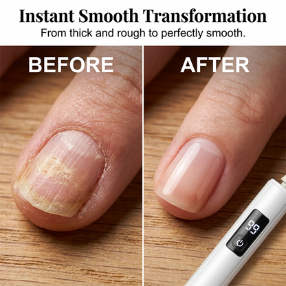🥳2026 HOT SALE🥳💞50K+ SOLD!💅✨ 49% OFF! Professional Electric Nail Polisher – Smooths thick nails, 99-speed display. Multiple heads for shaping & buffing. Salon at home! 🌟💎